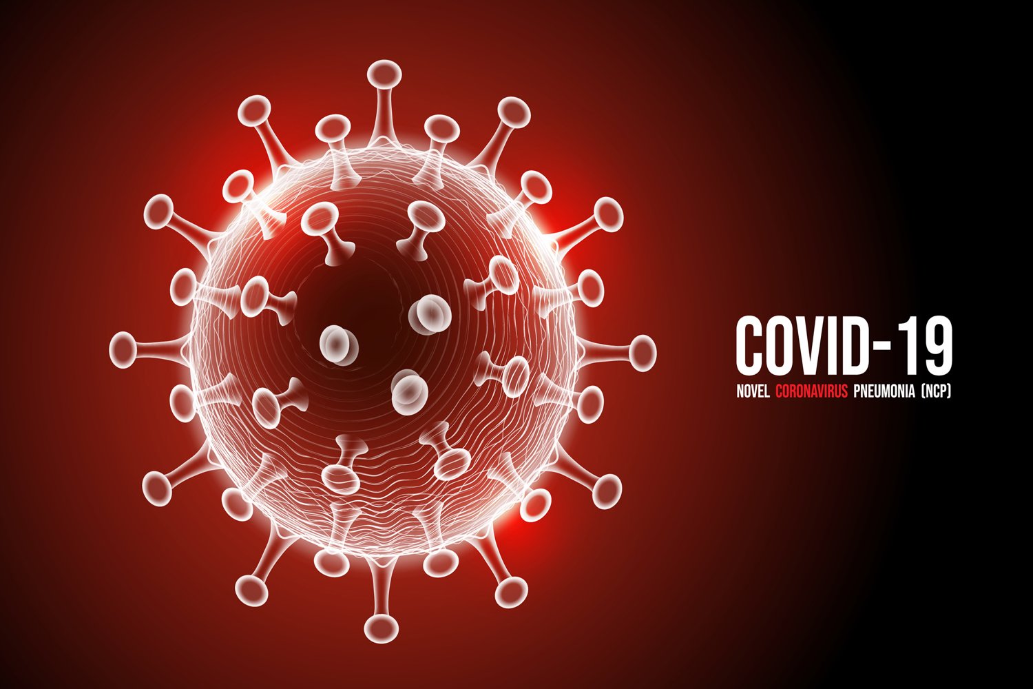 MEDIDAS DE CONTENCIÓN POR AUMENTOS DE COVID-19